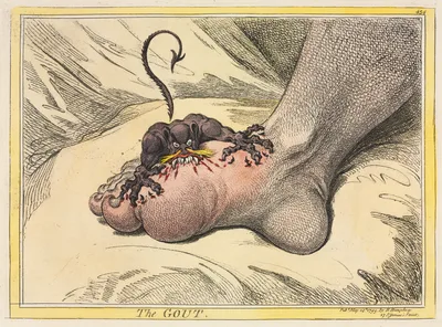 The Gout — James Gillray
